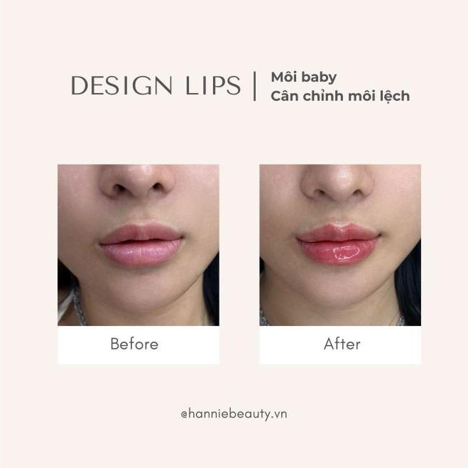 Design Lips môi baby trước và sau