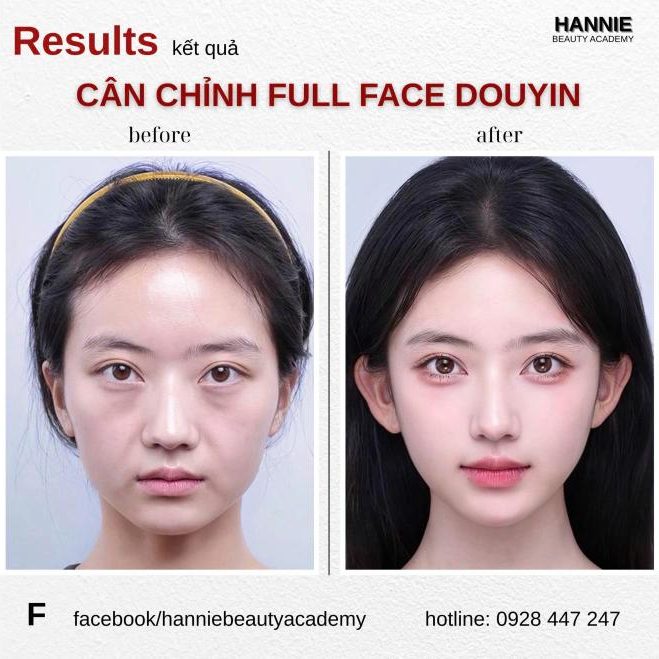 Cân chỉnh fullface Douyin trước và sau