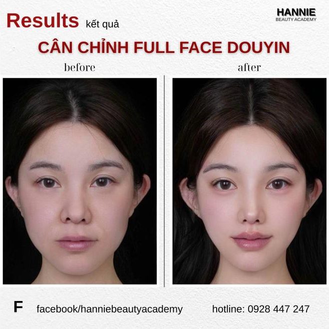 Cân chỉnh fullface trước và sau