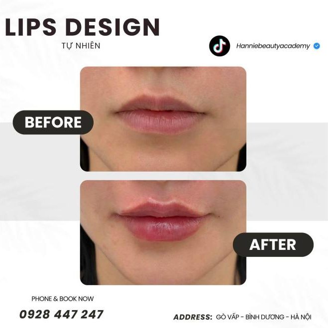 Lips design tự nhiên trước và sau