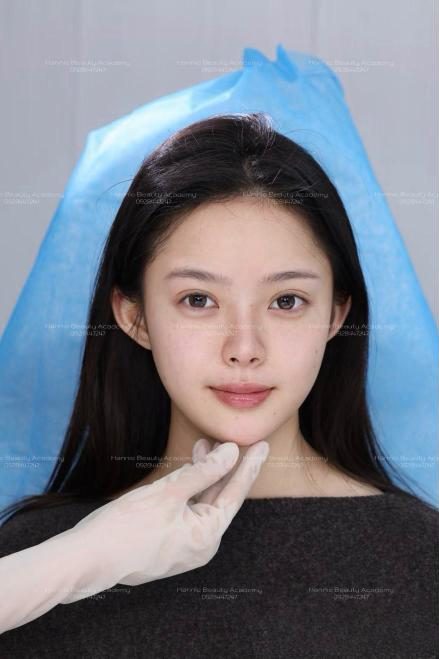 Khách hàng được chuyên gia Hannie kiểm tra đường nét gương mặt trước khi tiêm