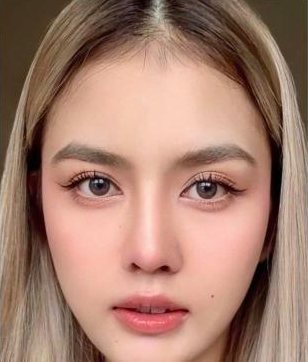 Gương mặt thon gọn sau khi tiêm botox hàm