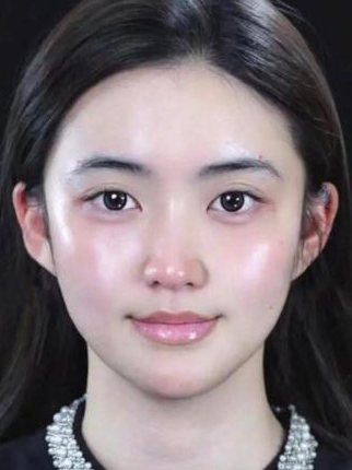 Gương mặt sau khi cân chỉnh fullface Douyin